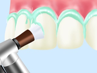 Preventive dentistry